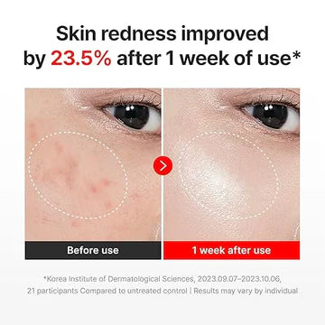 Centellian24 - Madeca Cream Time Reverse