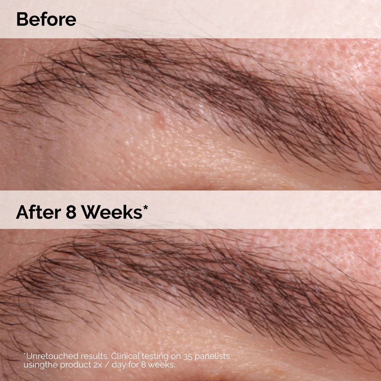 The Ordinary Multi Peptide Lash y Brow Serum